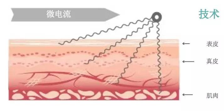 美容电流仪器_美容仪微电流对皮肤好吗_微电流美容仪副作用